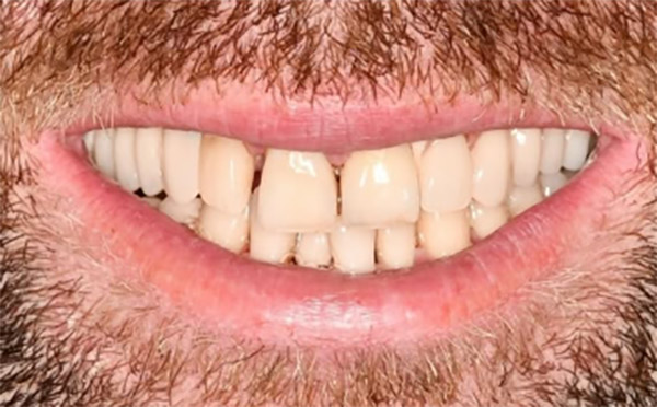 Pacientul înainte de procedură