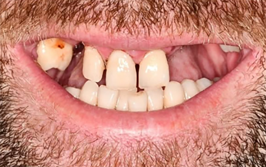 Pacientul după procedură