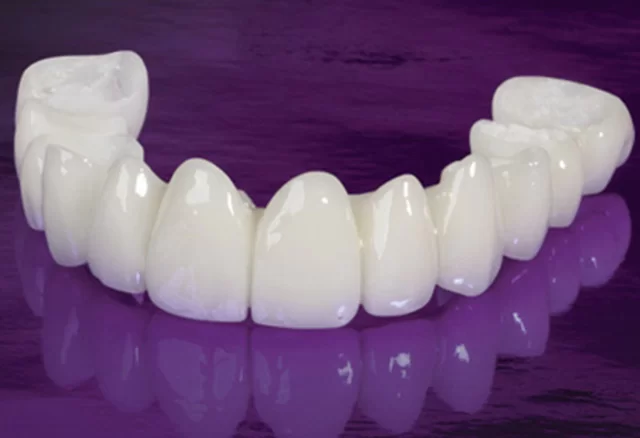 Știți ce sunt coroanele de Zirconiu?